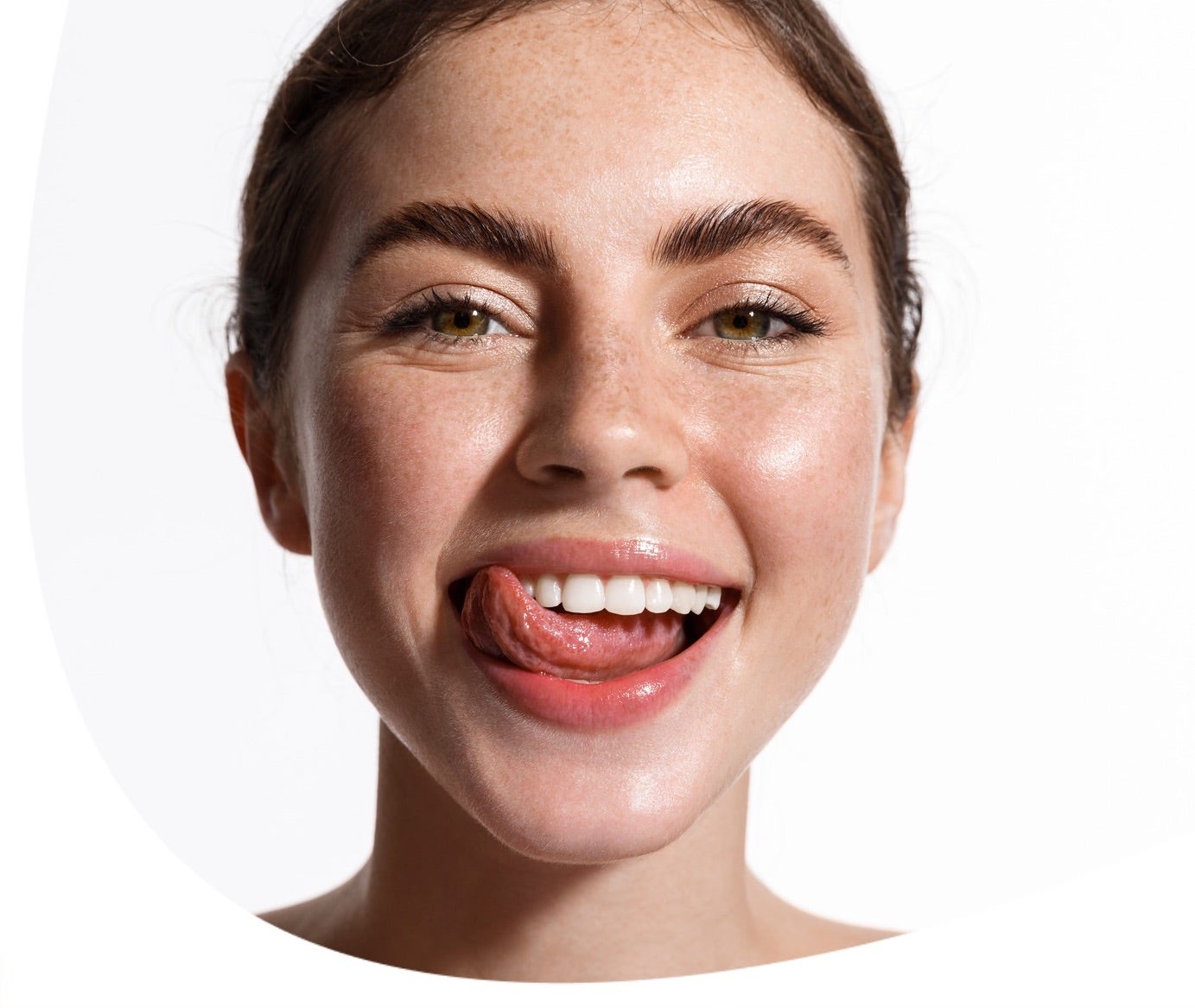 Fogínygyulladás: okok és következmények. Így előzd meg az ínybetegséget!